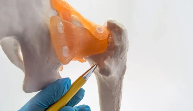 שברי צוואר ירך